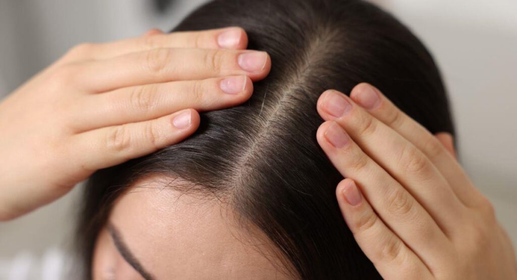 Patient receiving hair transplant treatment in Lahore