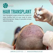Why Hair Transplant Is in High Demand Today
